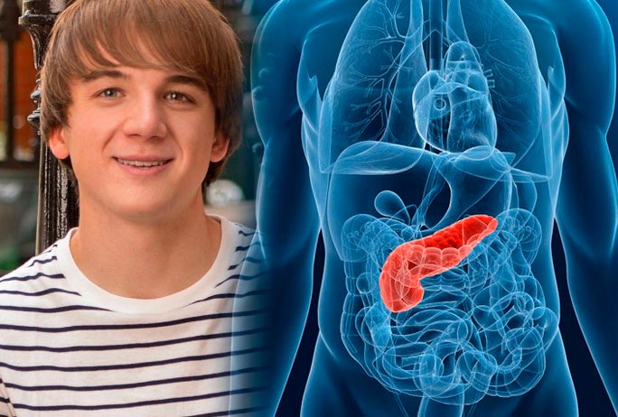 Un joven de 19 años quiere acabar con el cáncer de páncreas